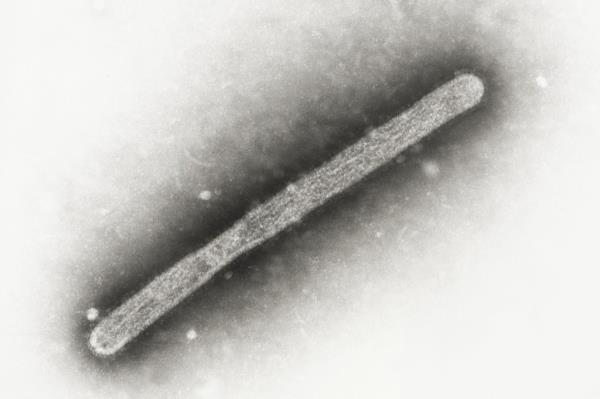 This electron microscope image shows an avian influenza A H5N1 virion.